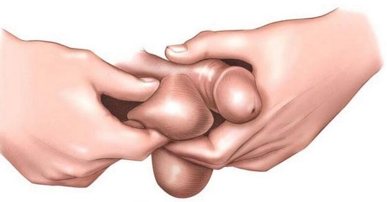 Parce que les œufs qui démangent chez les hommes
